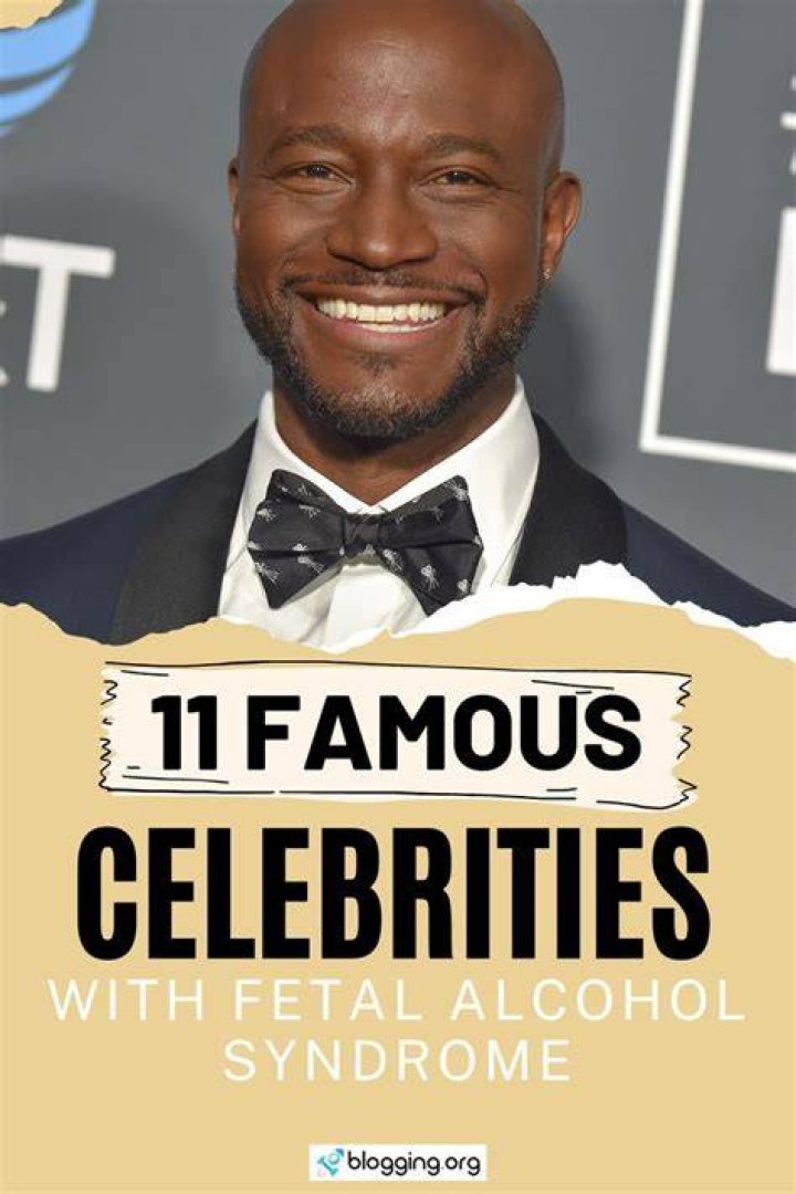 The Surprising Truth About Fetal Alcohol Syndrome And Celebrities